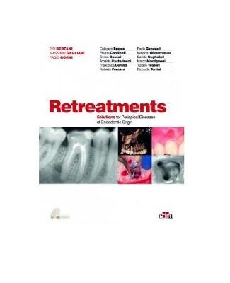 Retreatments. Solutions for periapical diseases of endodontic origin - copertina