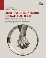 Adhesive cementation on natural teeth. Materials and techniques
