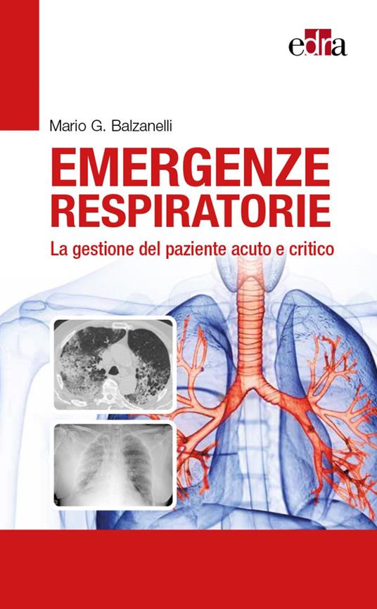 Emergenze respiratorie. La gestione del paziente acuto e critico - Mario Giosuè Balzanelli - copertina