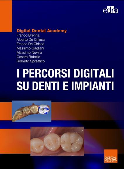 I percorsi digitali su denti e impianti - Franco Brenna,Franco De Chiesa,Alberto De Chiesa - copertina