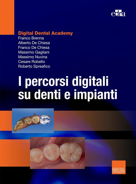 I percorsi digitali su denti e impianti - Franco Brenna,Alberto De Chiesa,Franco De Chiesa,Massimo Gagliani - ebook