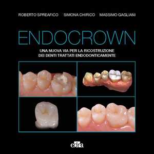 Libro Endocrown. Una nuova via per la ricostruzione dei denti trattati endodonticamente Roberto Spreafico Simona Chirico Massimo Gagliani