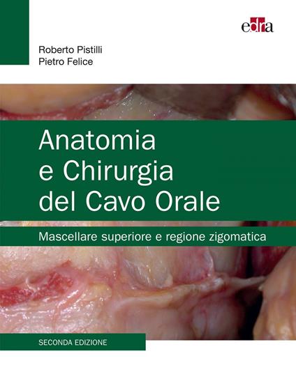 Anatomia e chirurgia del cavo orale. Mascellare superiore e regione zigomatica - Pietro Felice,Roberto Pistilli - ebook
