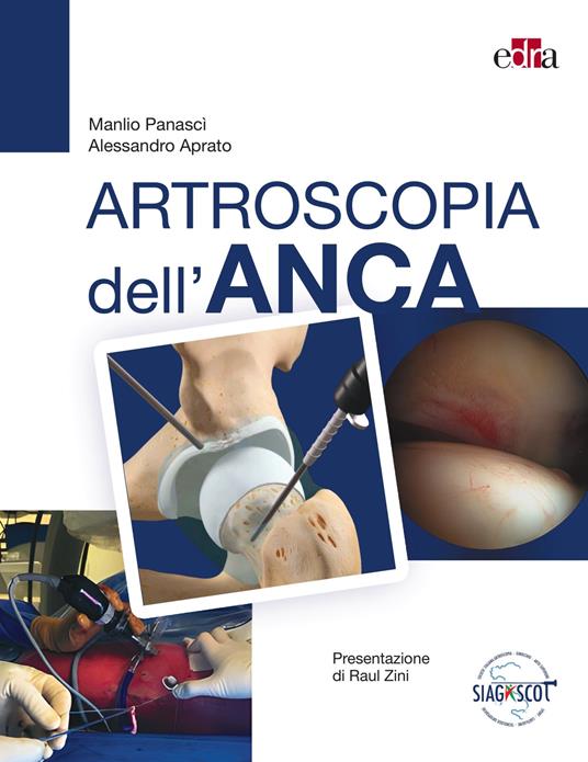 Artroscopia dell'anca - Manlio Panascì,Alessandro Aprato - copertina