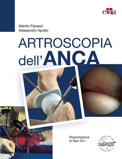 Artroscopia dell'anca - Alessandro Aprato,Manlio Panascì - ebook