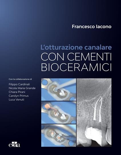 L' otturazione canalare con cementi bioceramici - Francesco Iacono - ebook