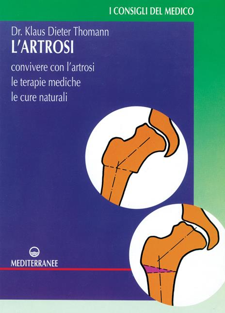 L' artrosi. Come convivere con l'artrosi. Le terapie mediche, le cure individuali - Klaus-Dieter Thomann - copertina