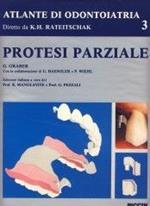 Protesi parziale
