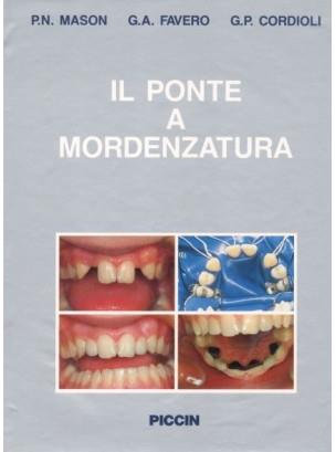 Il ponte a mordenzatura - P. Nicola Mason,G. Antonio Favero,G. P. Cordioli - copertina