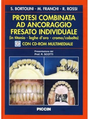 Protesi combinata ad ancoraggio fresato individuale (titanio, leghe d'oro, cromo, cobalto) - S. Bortolini,M. Franchi,R. Rossi - copertina