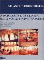 La patologia e la clinica della malattia parodontale
