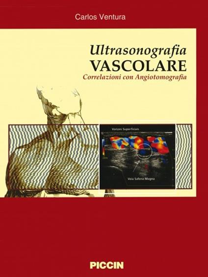 Ultrasonografia vascolare. Correlazioni con angiotomografia - Carlos Ventura - copertina