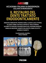 Il restauro del dente trattato endodonticamente