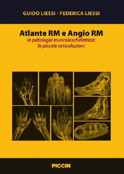 Atlante RM e angio RM in patologia muscoloscheletrica: le piccole articolazioni - Guido Liessi,Federica Liessi - copertina