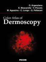 Color atlas of dermoscopy