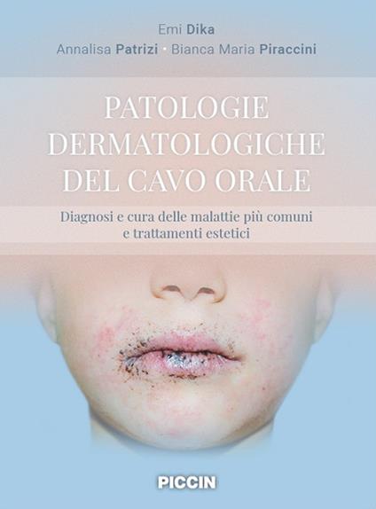 Patologie dermatologiche del cavo orale. Diagnosi e cura delle malattie più comuni e trattamenti estetici - Emi Dika,Annalisa Patrizi,Bianca Maria Piraccini - copertina