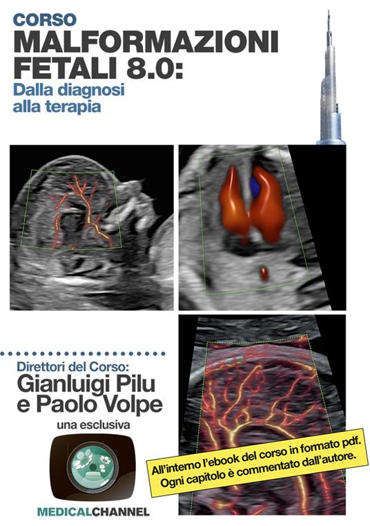 Malformazioni fetali 8.0: dalla diagnosi alla terapia - Gianluigi Pilu,Paolo Volpe - copertina