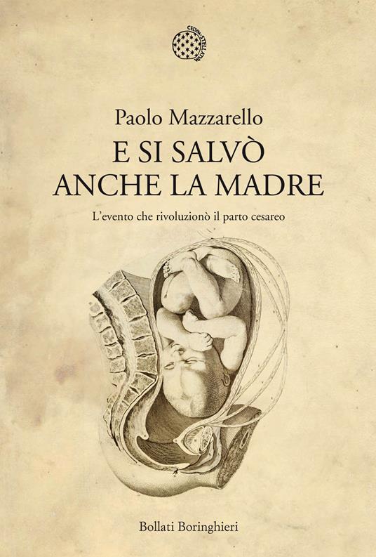 E si salvò anche la madre. L'evento che rivoluzionò il parto cesareo - Paolo Mazzarello - copertina