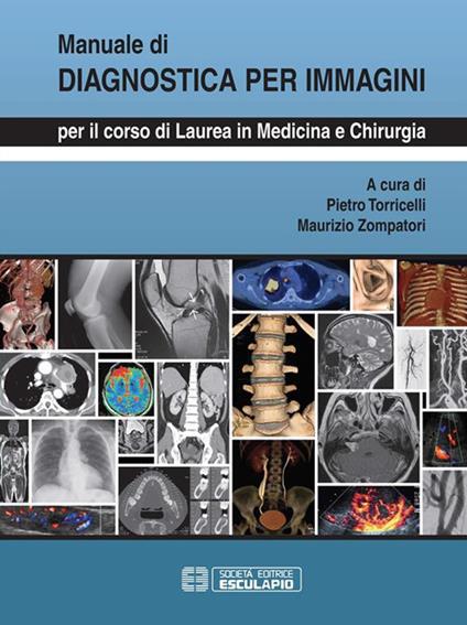 Manuale di diagnostica per immagini. Per il corso di laurea di medicina e chirurgia - Pietro Torricelli,Maurizio Zompatori - ebook