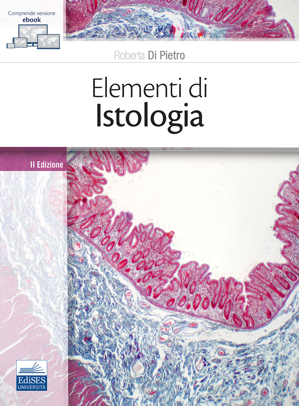 ibs