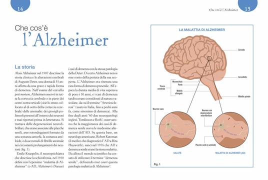 La dieta anti Alzheimer. Consigli e ricette per prevenire la malattia del terzo millennio - Cinzia Cuneo,Massimo Tabaton - 4