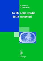 La TC nello studio delle metastasi