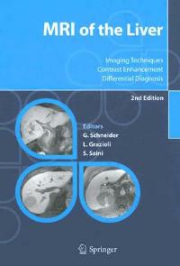 Mri of the liver. Imaging techniques, contrast enhancement, differential diagnosis - Guenther Schneider,Luigi Grazioli,Sanjay Saini - copertina