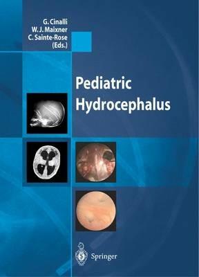 Pediatric hydrocephalus - copertina