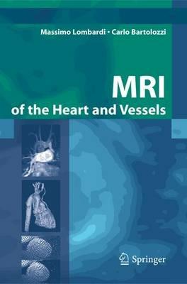 MRI of the heart and vessels - Massimo Lombardi,Carlo Bartolozzi - copertina