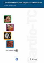 TC multidetettore nella diagnostica cardiovascolare. Con CD-ROM. Con DVD