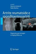 Artrite reumatoide e spondiloentesoartriti