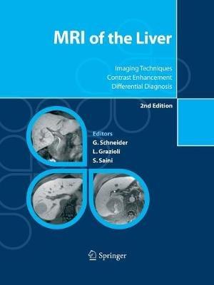 MRI of the Liver: Imaging Techniques, Contrast Enhancement, Differential Diagnosis - cover
