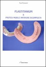 Plastitanium & protesi mobile inferiore bicomposta