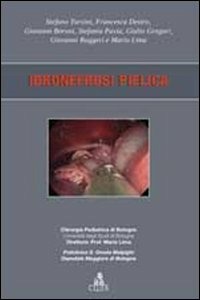 ibs