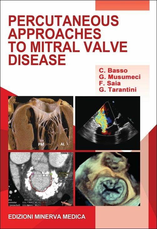 Percutaneous approaches to mitral valve disease - Cristina Basso,Giuseppe Musumeci,Francesco Saia - copertina