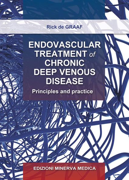 Endovascular treatment of chronic deep venous disease. Principles and practice - Rick De Graaf - copertina
