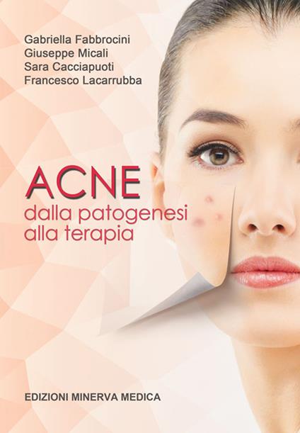 Acne. Dalla patogenesi alla terapia - Gabriella Fabbrocini,Giuseppe Micali,Sara Cacciapuoti - copertina