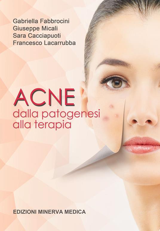 Acne. Dalla patogenesi alla terapia - Gabriella Fabbrocini,Giuseppe Micali,Sara Cacciapuoti - copertina