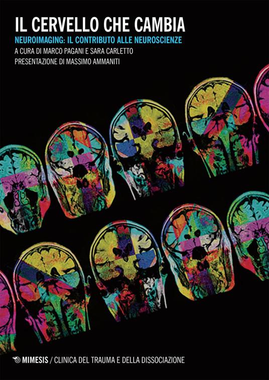 Il cervello che cambia. Neuroimaging: il contributo alle neuroscienze - Sara Carletto,Marco Pagani - ebook