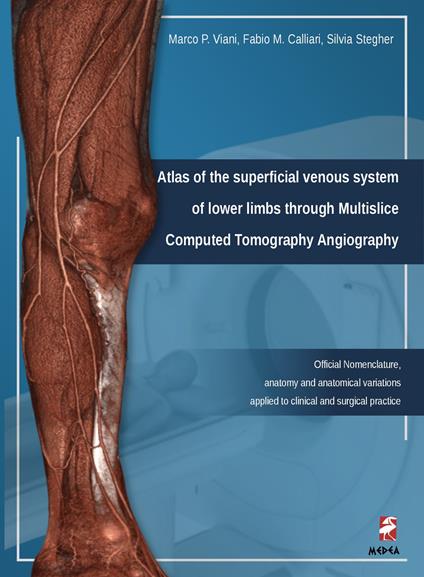 Atlas of the superficial venous system. Of lower limbs through Multislice Computed Tomography Angiography. Ediz. illustrata - Marco P. Viani,Fabio Calliari,Silvia Stegher - copertina