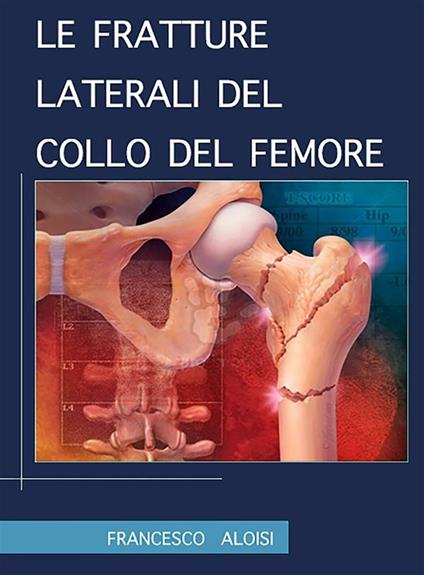 Le fratture laterali del collo del femore - Francesco Aloisi - ebook