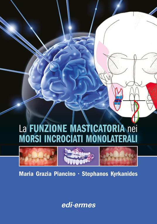 La funzione masticatoria nei morsi incrociati monolaterali - Maria Grazia Piancino,Stephanos Kyrkanides - copertina