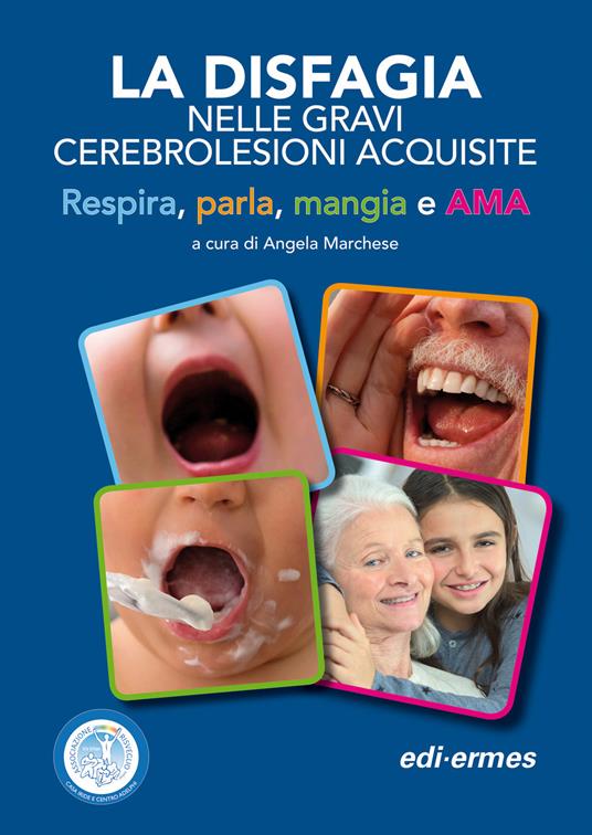 La disfagia nelle gravi cerebrolesioni acquisite. Respira, parla, mangia e AMA - Angela Marchese - copertina
