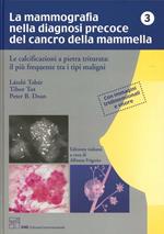 La mammografia nella diagnosi precoce del cancro della mammella. Le calcificazioni a pietra triturata. Il più frequente tra i tipi maligni. Con occhiali 3D