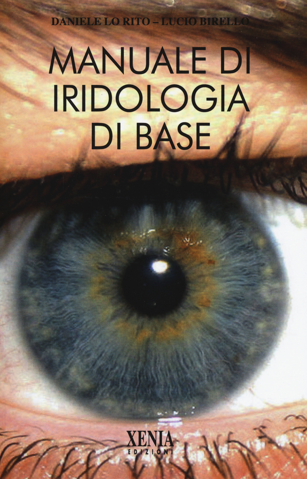 ibs