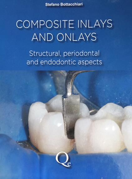 Composite inlays and onlays - Stefano Bottacchiari - copertina