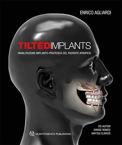 Tilted implants. Riabilitazione implanto-protesica del paziente atrofico - Enrico Agliardi,Davide Romeo,Matteo Clericò - copertina