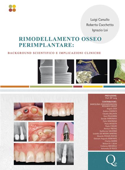Rimodellamento osseo perimplantare. Background scientifico e implicazioni cliniche - Luigi Canullo,Roberto Cocchetto,Ignazio Lio - copertina