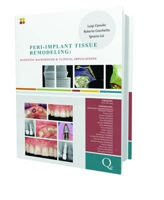 Peri-implant tissue remodeling. Scientific background and clinical implications - Luigi Canullo,Roberto Cocchetto,Ignazio Loi - copertina