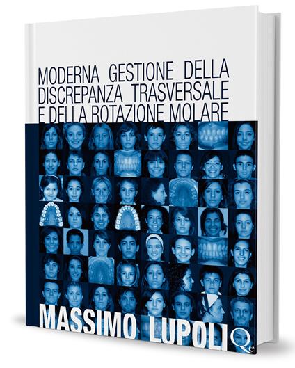 Moderna gestione della discrepanza trasversale e della rotazione molare. Il palatal expander - Massimo Lupoli - copertina